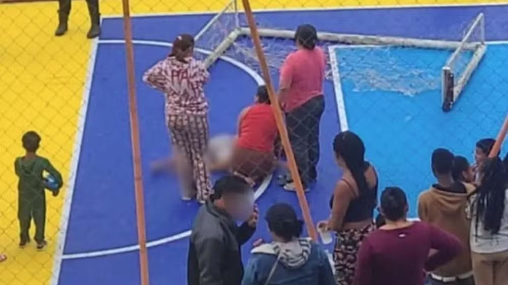 Menino ficou ferido em Itajaí após trave de futebol cair na cabeça dele. (Foto: Reprodução)