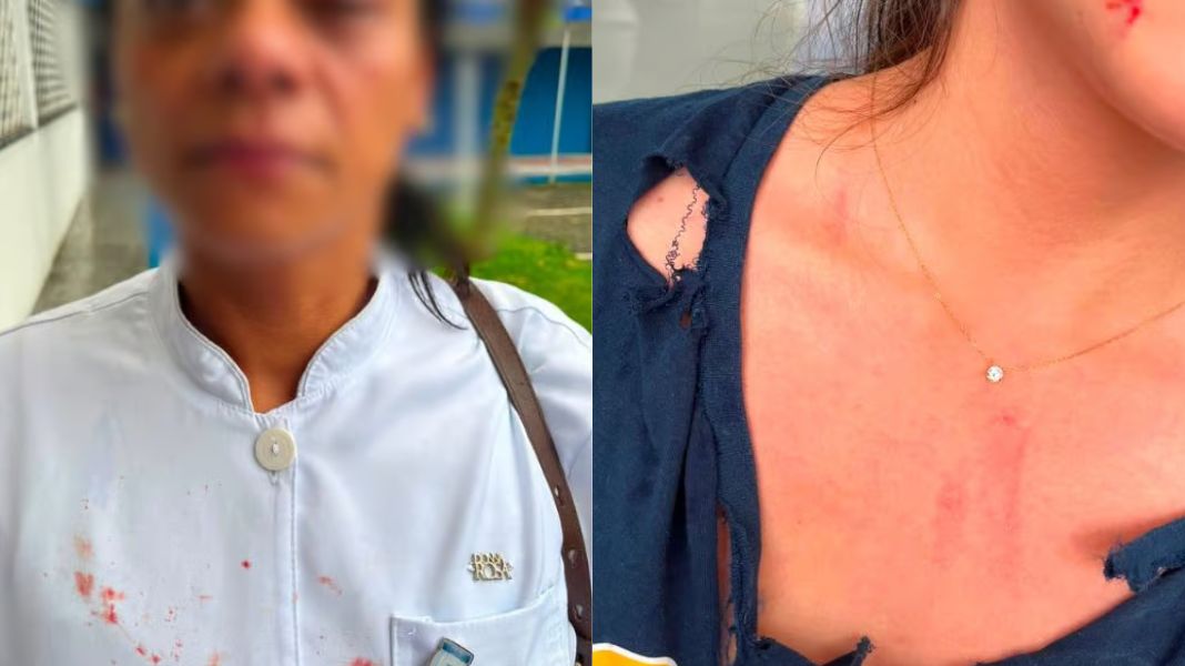 A estagiária teve a roupa rasgada e sofreu lesões no rosto e arranhões no colo (foto direita). A outra profissional teria recebido um soco na região do olho esquerdo (foto esquerda). (Crédito das imagens - Reprodução.)